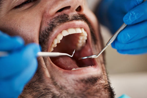 Best Walk-In Emergency Dentist in Thomaston, GA